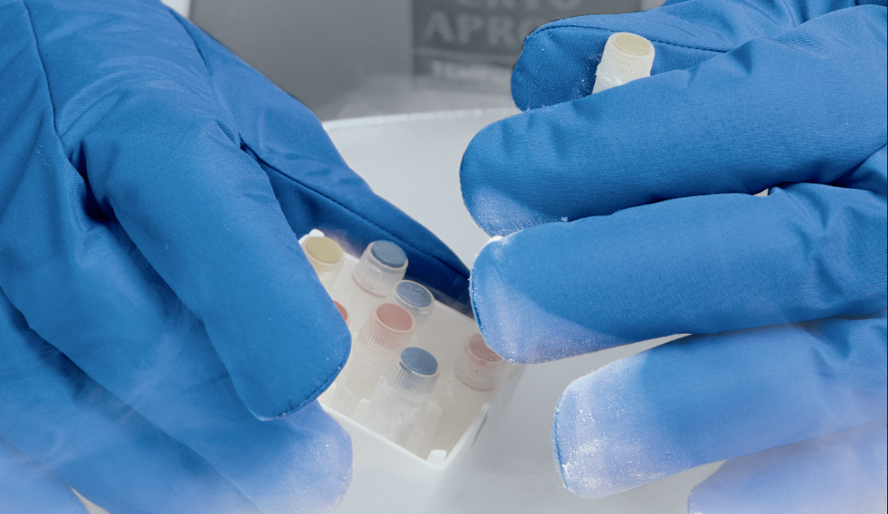 Cryo Gloves Cryo Gloves Wrist Grip GERF® Certified Cryo Gloves